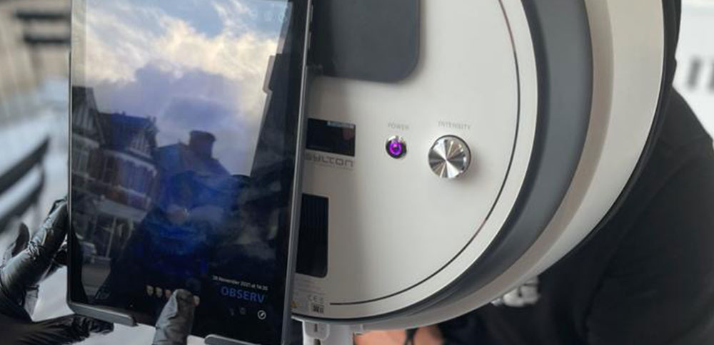 Observe Skin Scanner