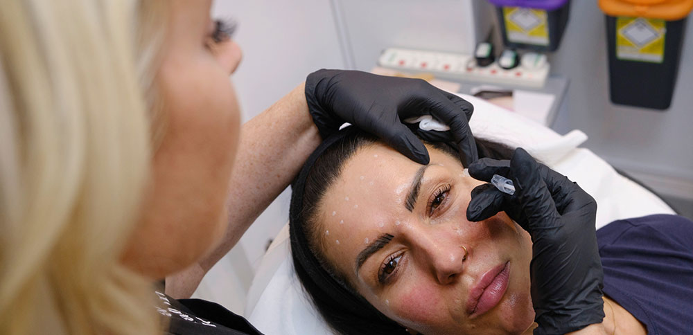 Botox