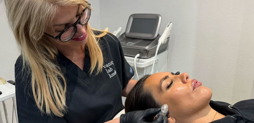 Exosome microneedling